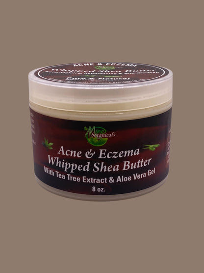 ACNE& ECZENA (Whipped Shea Butter)